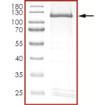 HER2 (C805S), Active